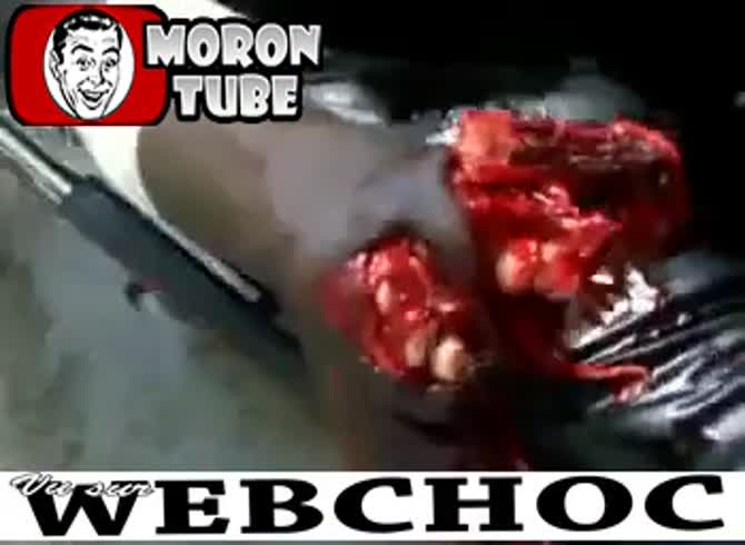 Video :A firework totally destroying a hand (public warning)